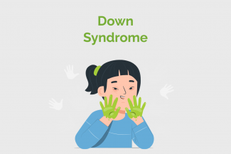Causes Of Down Syndrome | Risk factors for developing Down syndrome